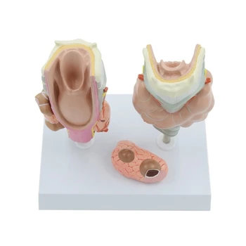 F3MA Патологическая анатомическая модель щитовидной железы Модель гортани для изучения заболеваний Медицинская лекция