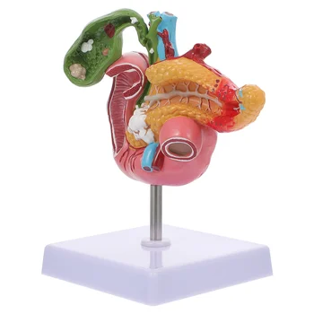 Патологическая модель Инструменты для изучения анатомии желчного пузыря Поражения поджелудочной железы Анатомический аппарат человека Модели из ПВХ Шовный материал для тела